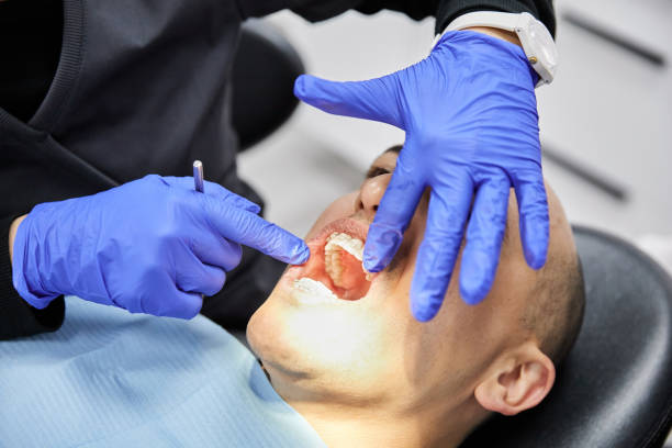 Best Broken or Cracked Tooth Emergency Dentist in Kingston, RI