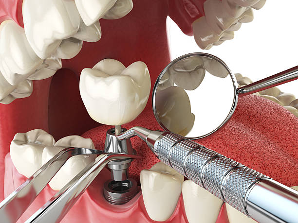 Best Emergency Dental Services for Seniors in Kingston, RI